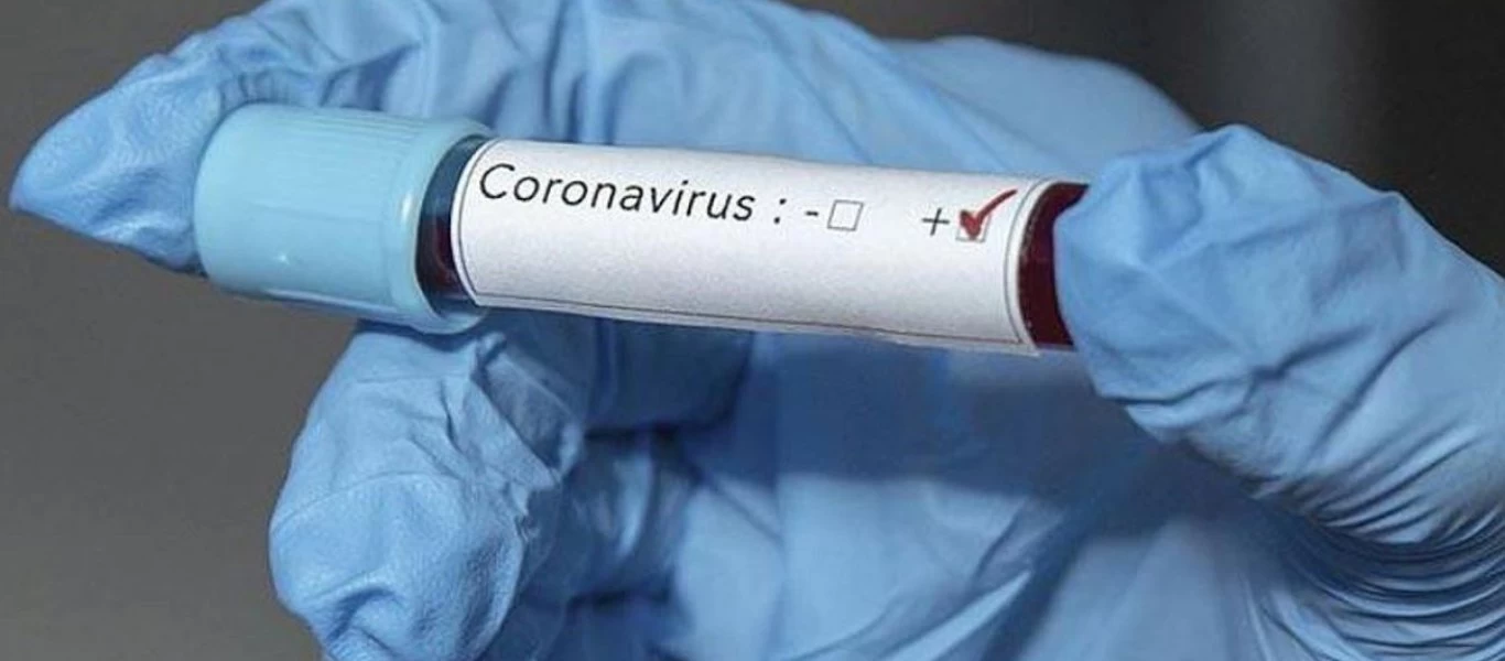 Πώς γίνονται τα τεστ του κορωνοϊού; - Δείτε την διαδικασία (βίντεο)